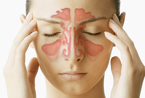 Perbedaan Sinus dengan Sinusitis